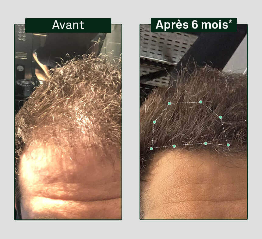 sampon-creștere